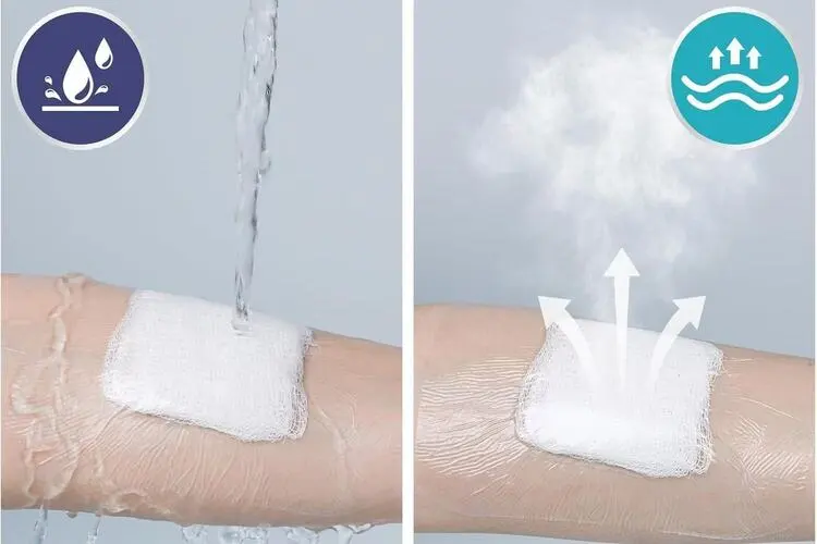 Transparent wound dressing Transparent wound dressing