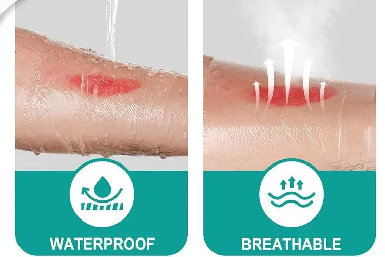 IV transparent dressing