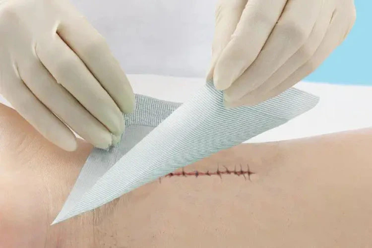 Silk surgical tape Silk surgical tape