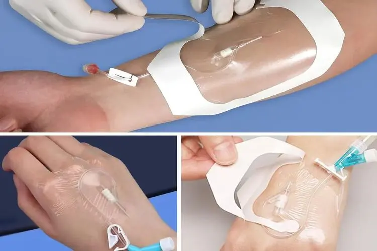 transparent dressing