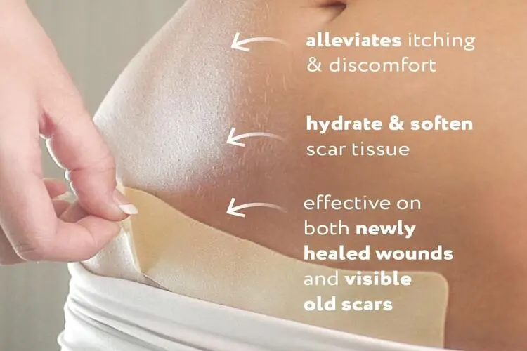 Silicone Scar Tape Silicone Scar Tape