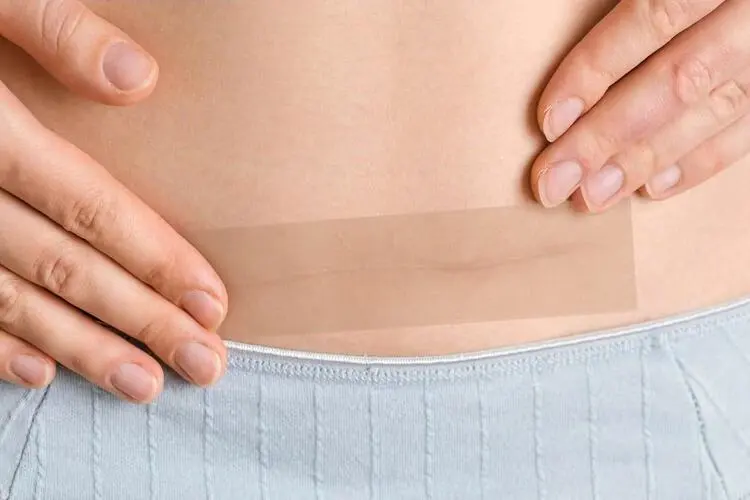 Silicone Scar Tape