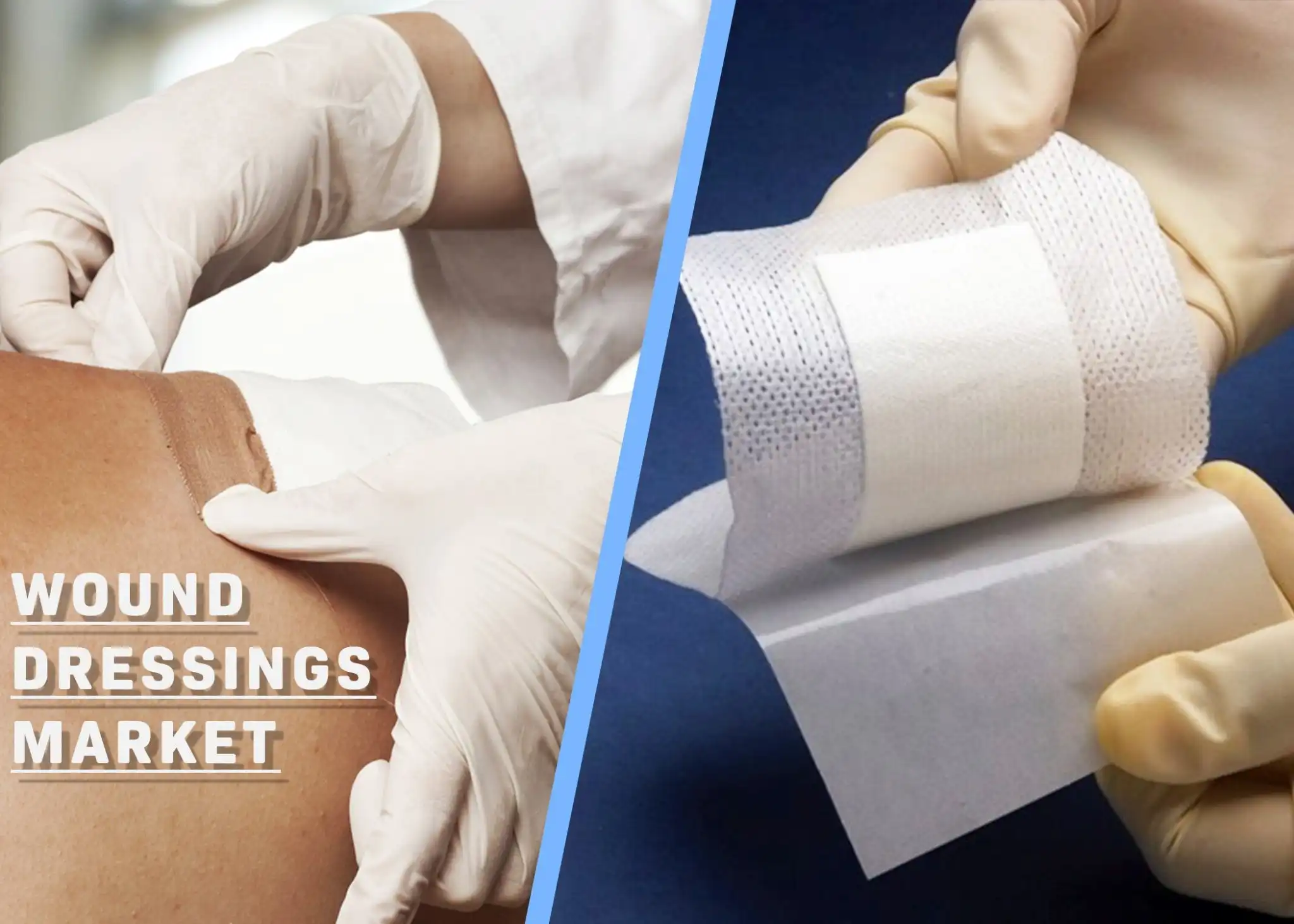 Island Dressing Wounds Island Dressing Wounds