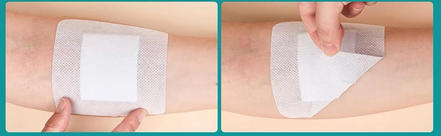 Sterile Wound Dressing