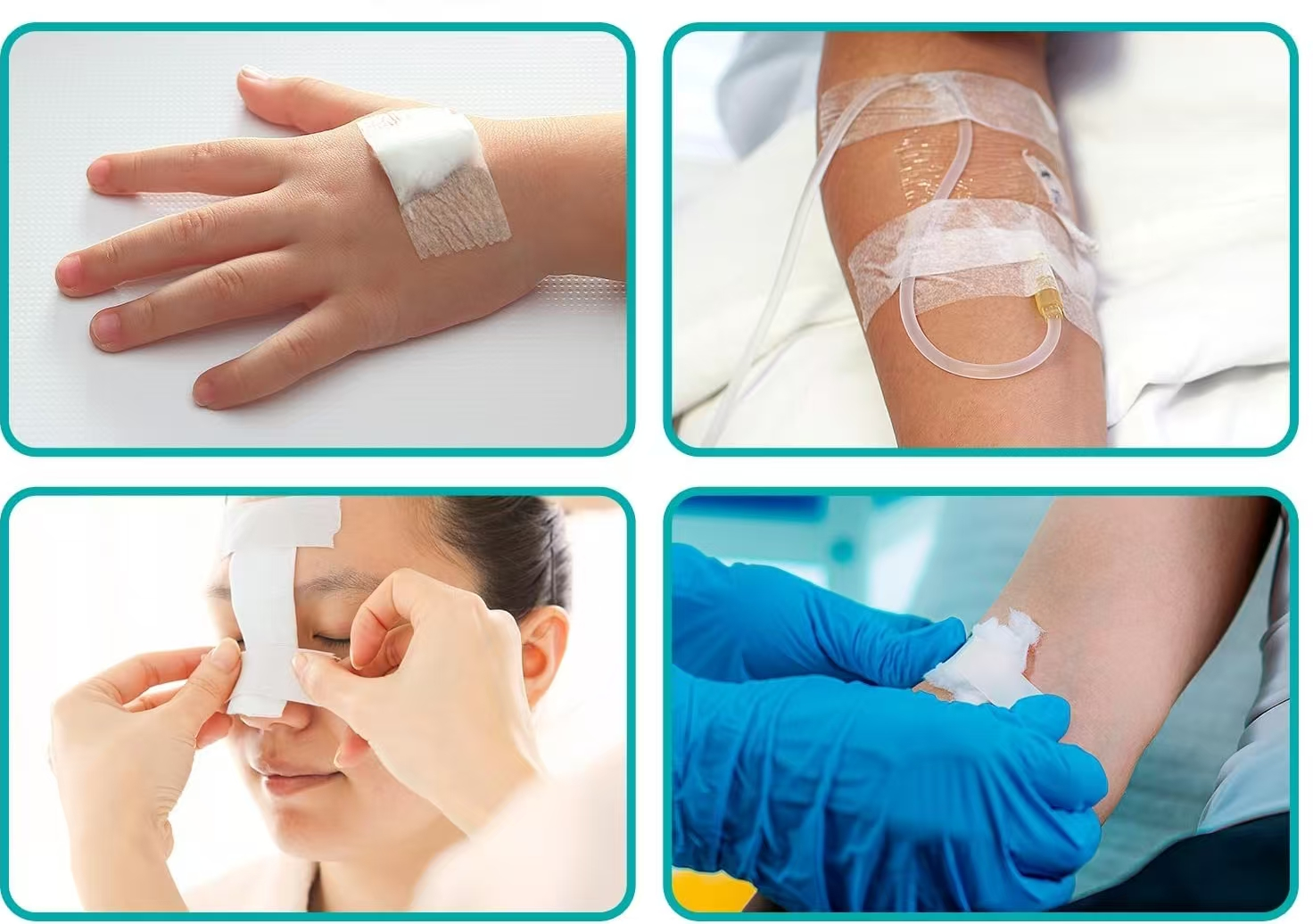 Hypoallergenic Surgical Tape