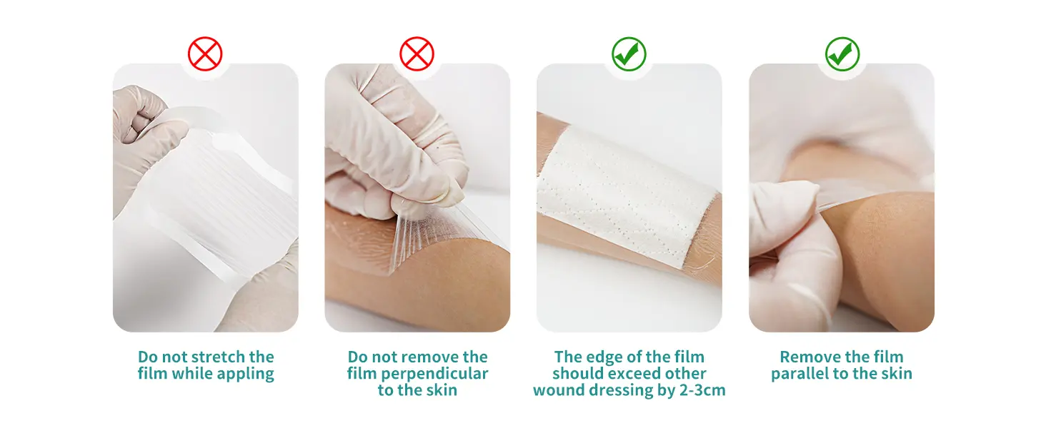 Waterproof Wound Dressings Waterproof Wound Dressings