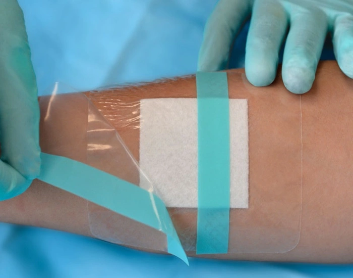 wound dressing wound dressing