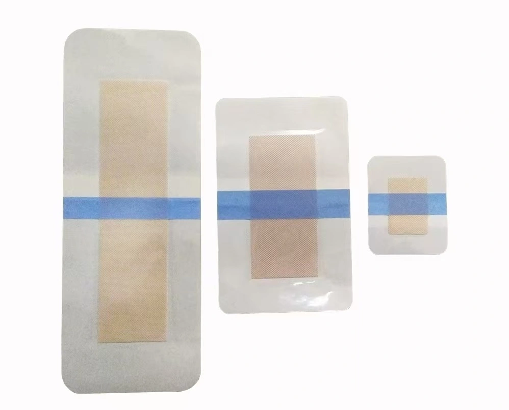 wound dressing wound dressing
