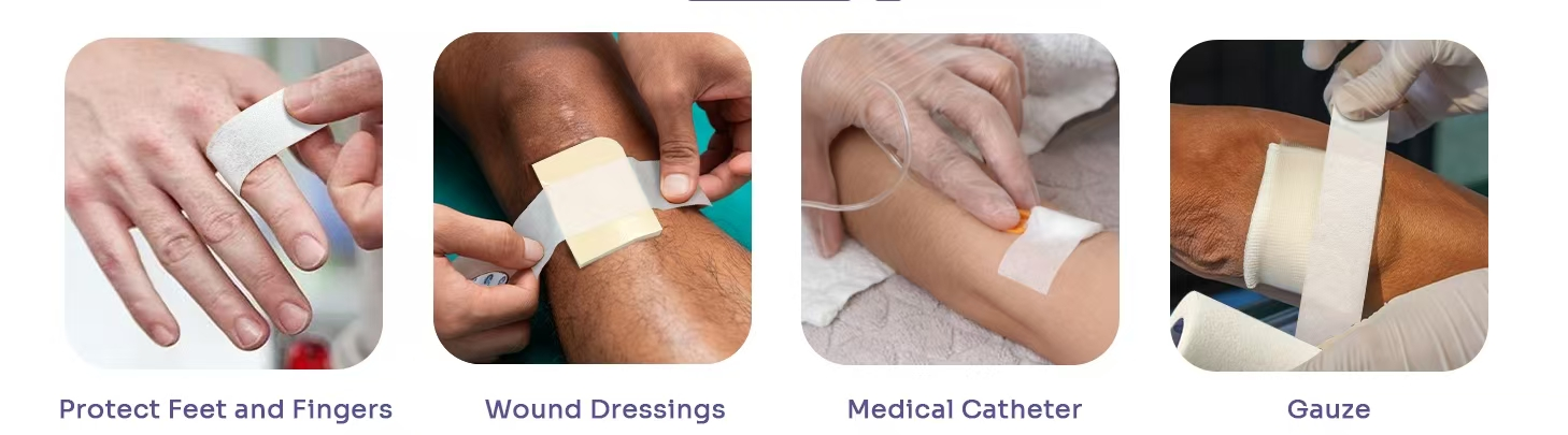 microporous medical tape