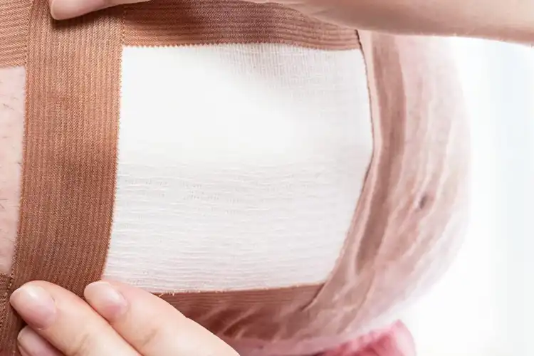 Non Woven Dressing Pad