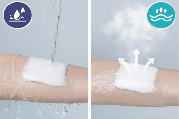 IV Transparent Dressing IV Transparent Dressing