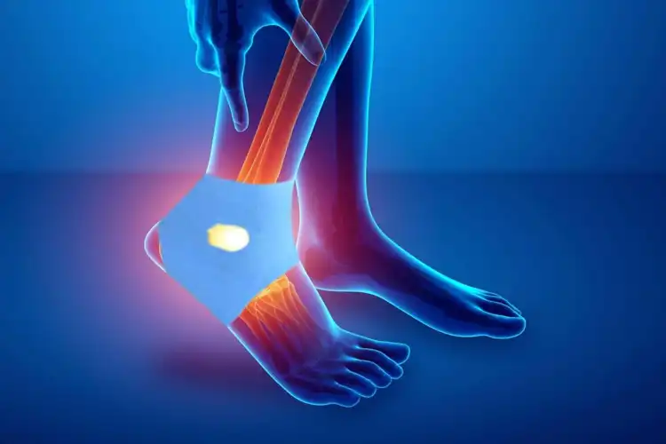 Ankle Support Kinesio Tape Ankle Support Kinesio Tape