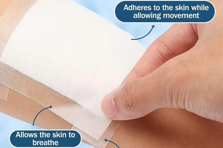Exploring the Hypoallergenic Nature of Medical Cloth Tape