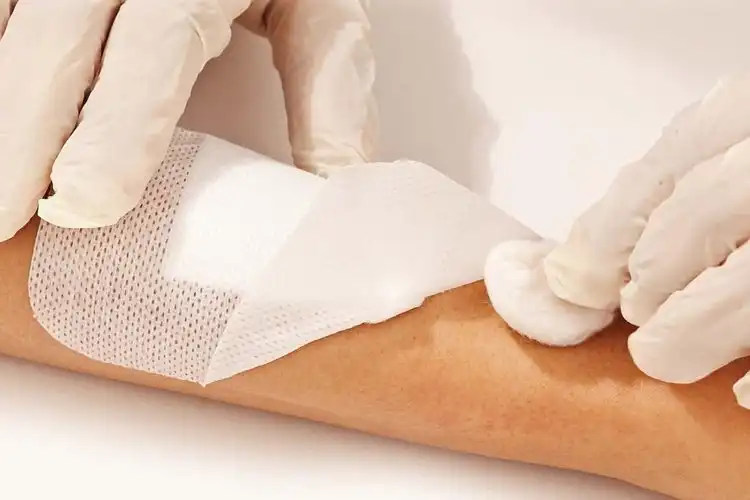 Non Woven Dressing Pads: The Future of Wound Management?