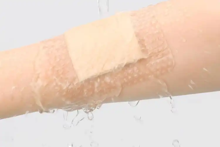 Foam Dressing with PU Film: Diabetic Foot Ulcer Game-Changer?