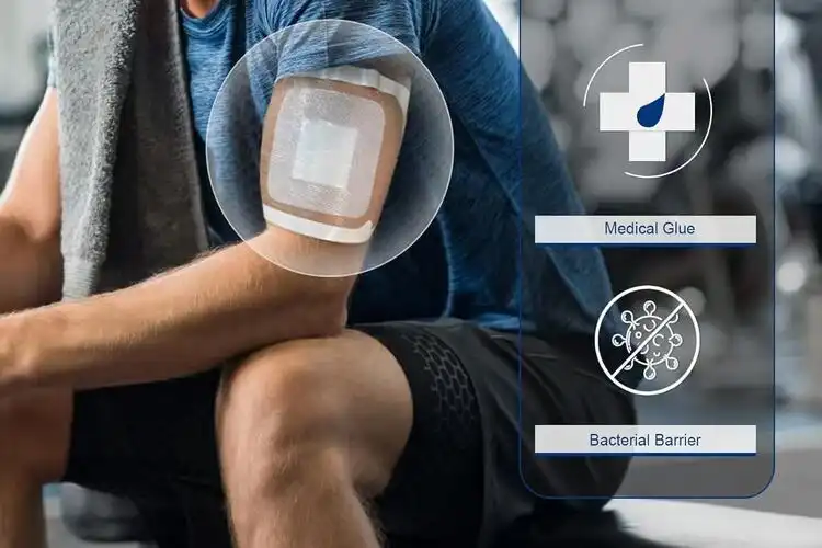Best Benefits of IV Transparent Dressing You Should Know