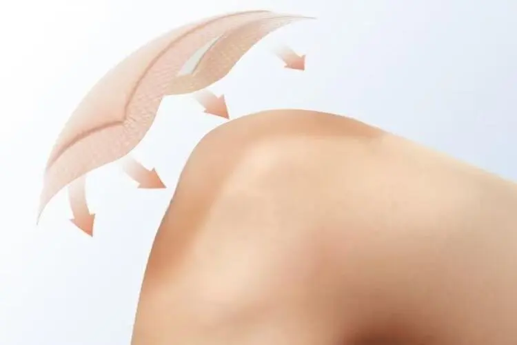 How Non Woven Wound Dressing Manages Exudate?