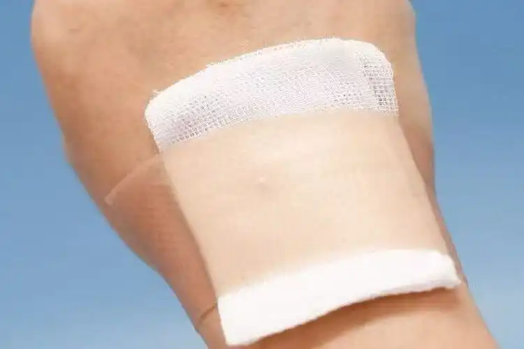 Accelerate Wound Healing: The Power of Silicone Scar Tape