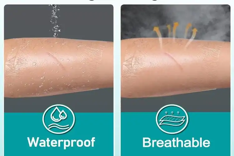 Innovations in Antimicrobial Transparent Wound Dressing