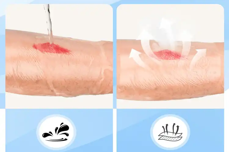 Exploring the Versatility of IV Transparent Dressing in Healthcare