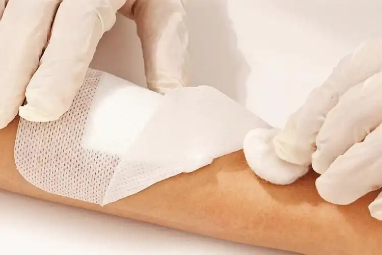 Are Non Adhesive Dressings Suitable for Sensitive Skin?