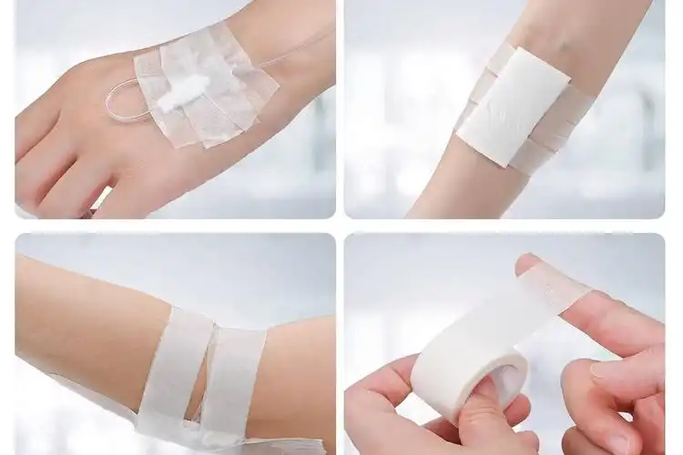 How should I apply and remove medical paper tape after surgery?