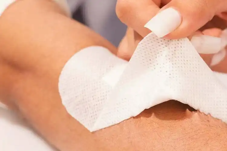 How should I choose a non woven dressing for chronic ulcers?