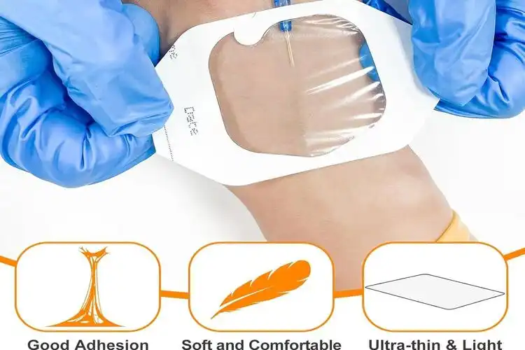 Transparent Dressing Cost Guide for Global Medical Buyers