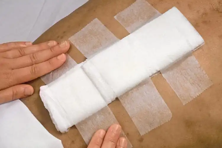 Is Silk Surgical Tape Better Than Paper and Plastic Alternatives?