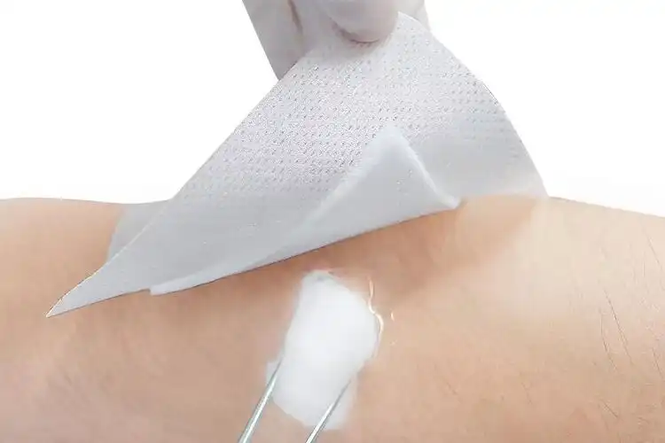 How do non woven dressings lower infection risk in surgical wounds?
