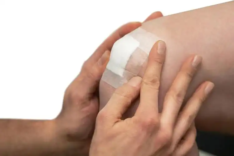 Comparing Microporous Surgical Tape to Traditional Adhesives