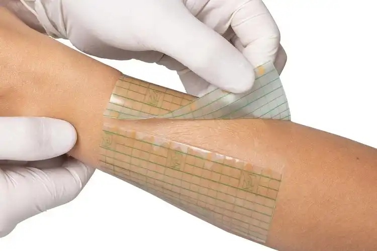 Transparent Film Dressing: Your Skin's Invisible Shield