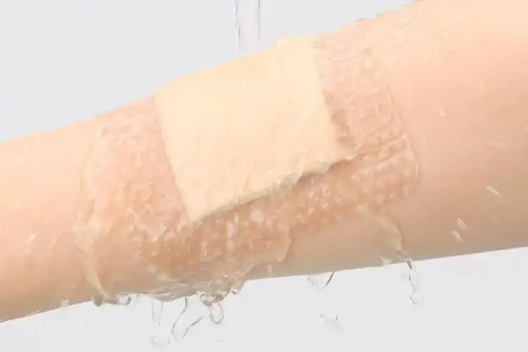 Is Foam Dressing with PU Film the Ultimate Pressure Ulcer Solution?